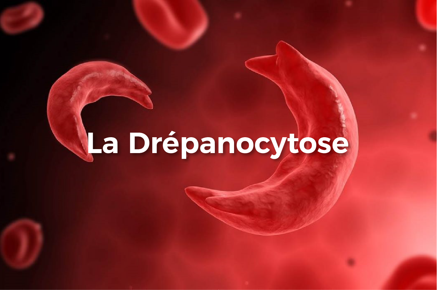 You are currently viewing Lutte contre la drépanocytose