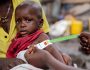 Nord Kivu: Les cas de malnutrition infantile s&rsquo;intensifies